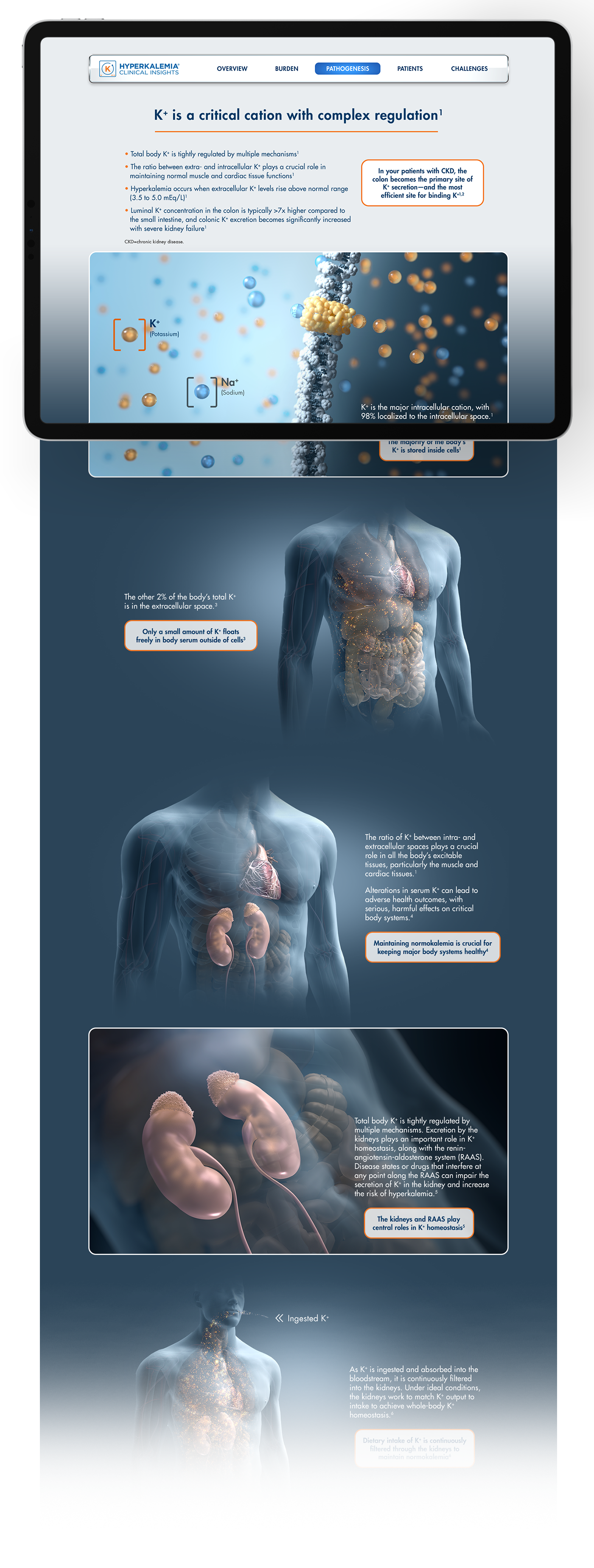 Hyperkalemia Insights - Interior Page