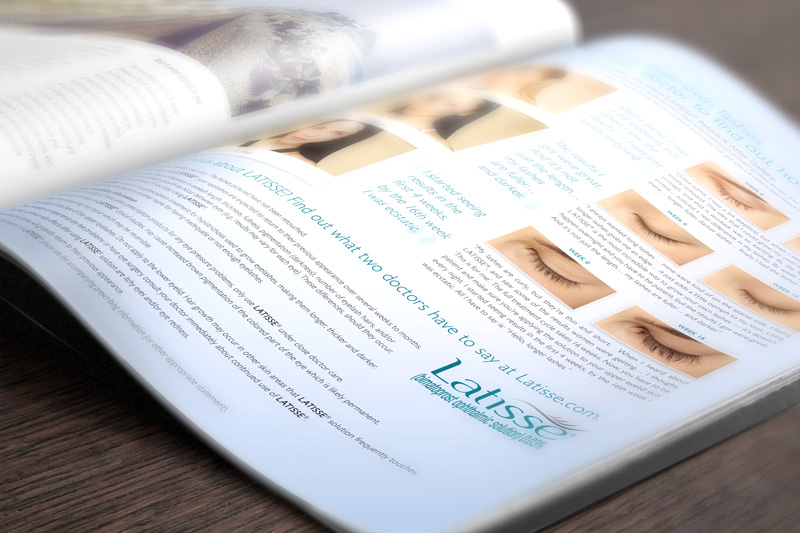 Latisse Print Ad